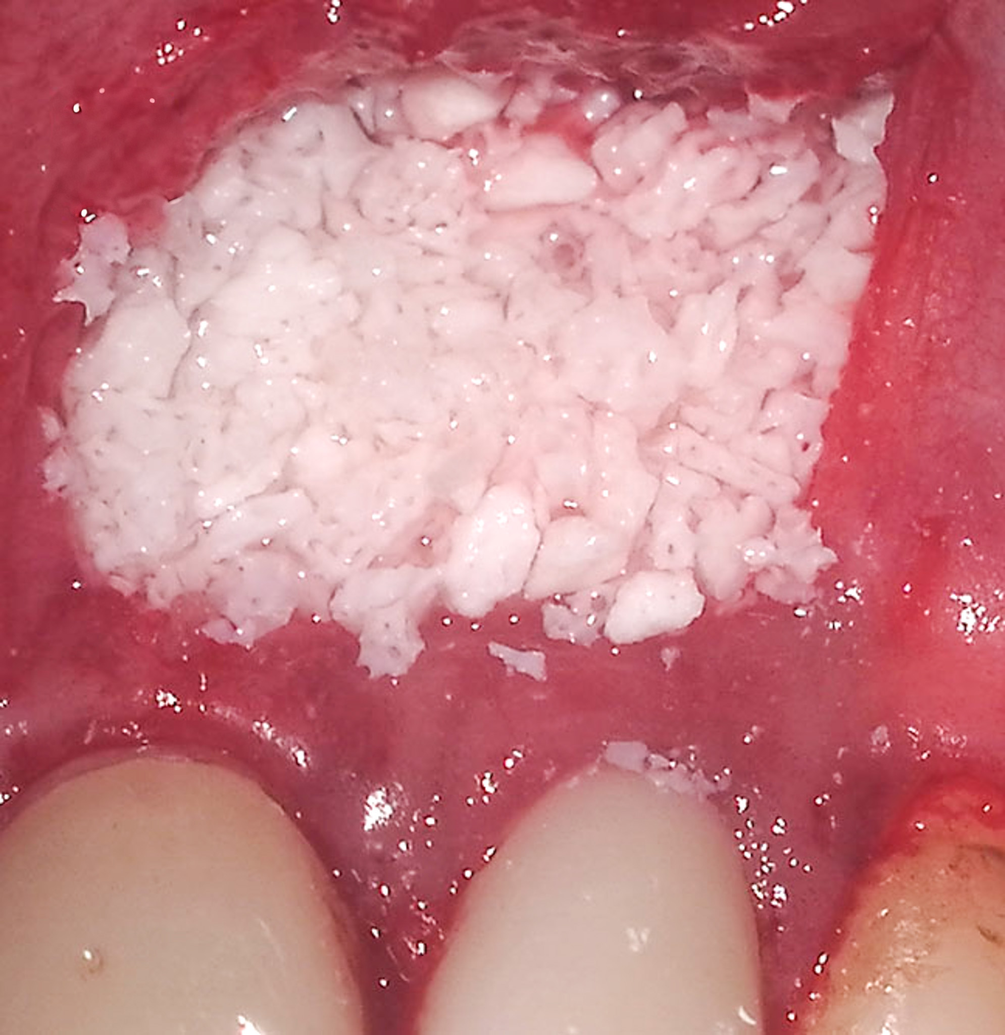 Care at Smile Dental Clinic isn't just painless but enjoyable experience